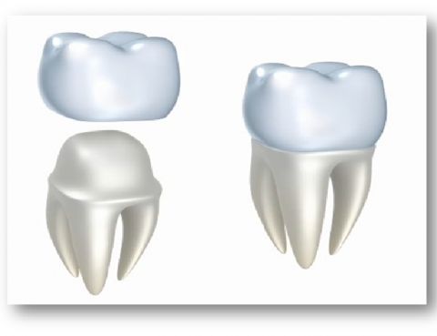 fundas dentales