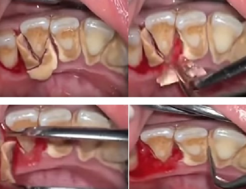 sarro dental