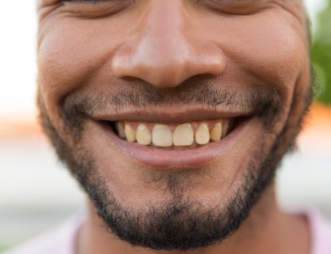 manchas marrones en los dientes