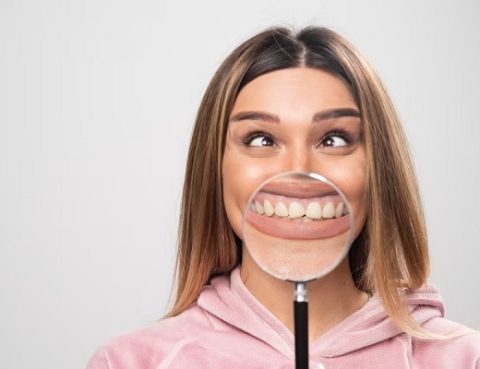 Sonrisa gingival, ¿Qué es?