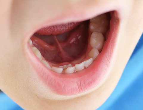 Dientes de tiburón