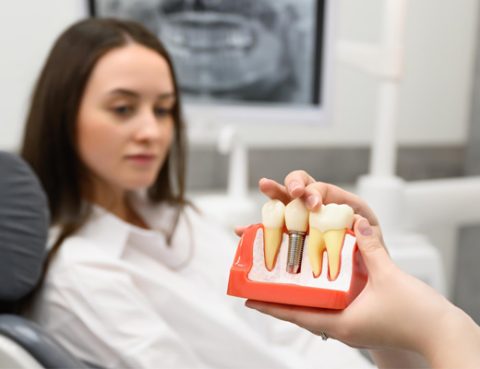 Enfermedades causadas por implantes dentales
