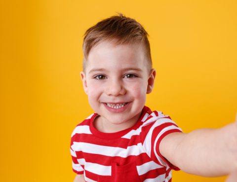 Niños con dientes amarillos