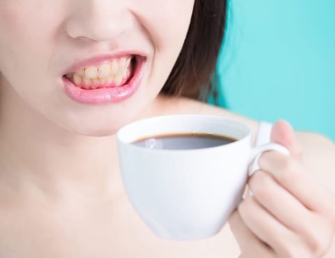 Qué alimentos tiñen los dientes