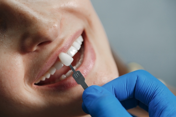 Los mejores dentistas en implantes