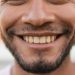 manchas marrones en los dientes